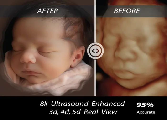 Turn Your 3D Ultrasound Into a Beautiful Work of Art