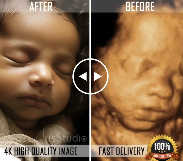 Turn Your 3D Ultrasound Into a Beautiful Work of Art